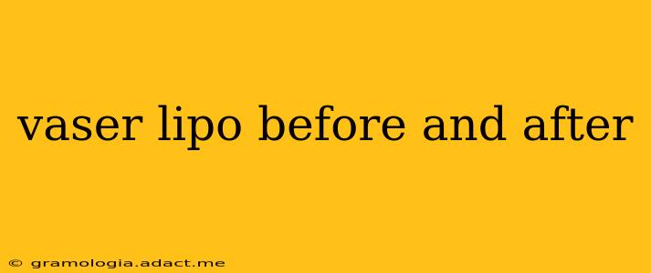 vaser lipo before and after