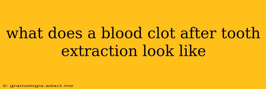 what does a blood clot after tooth extraction look like