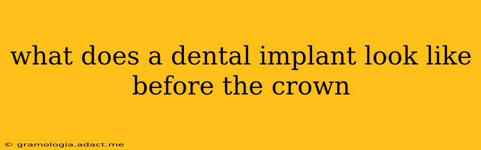 what does a dental implant look like before the crown