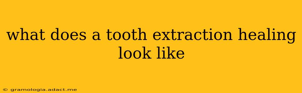 what does a tooth extraction healing look like