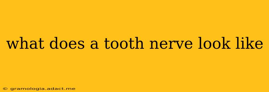 what does a tooth nerve look like