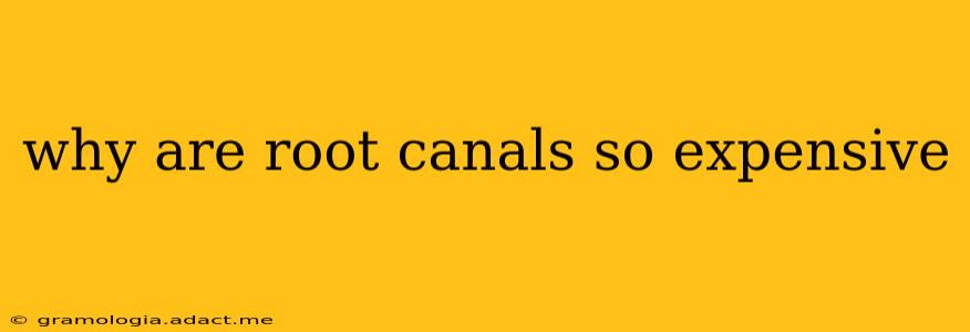 why are root canals so expensive