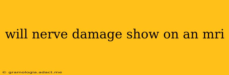 will nerve damage show on an mri