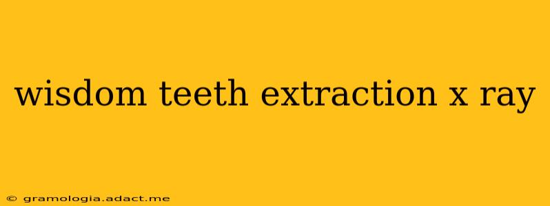 wisdom teeth extraction x ray